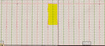 Photo 4 for 8100 W 6600 N